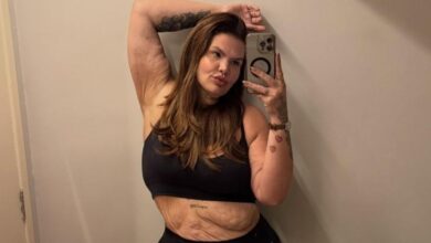 Thais Carla faz cirurgia bariátrica após chegar a pesar 140 kg e inicia nova fase em busca de saúde