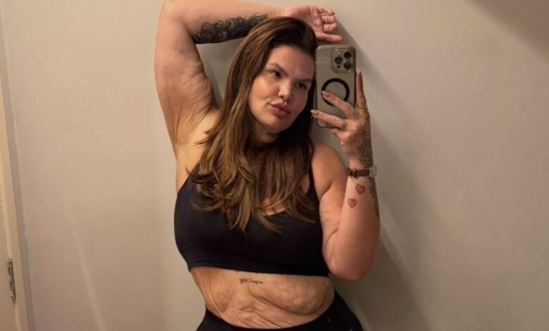 Thais Carla faz cirurgia bariátrica após chegar a pesar 140 kg e inicia nova fase em busca de saúde